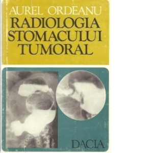 Radiologia stomacului tumoral