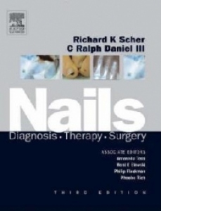 Nails : Diagnosis, Therapy, Surgery