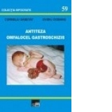 Antiteza omfalocel gastroschizis