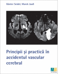 Principii si practica in accidentul vascular cerebral