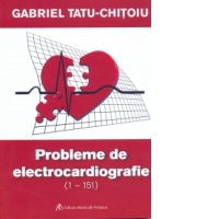 151 probleme de electrocardiografie