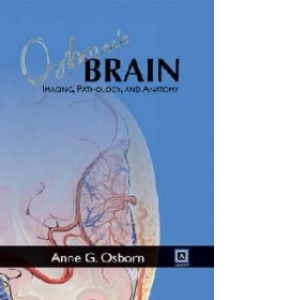 Osborns Brain - Imaging, Pathology and Anatomy