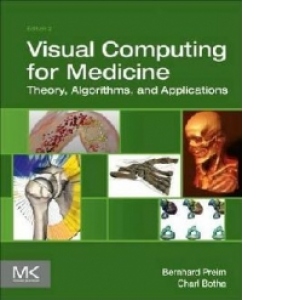 Visual Computing For Medicine - Theory, Algorithms and Applications