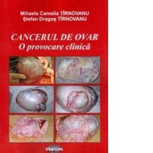 Cancerul de ovar. O provocare clinica