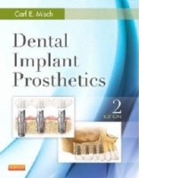 Dental Implant Prosthetics