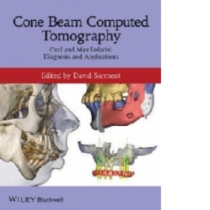 Cone Beam Computed Tomography