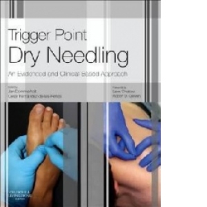 Trigger Point Dry Needling