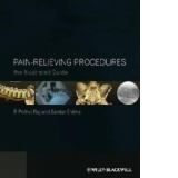 Pain-relieving Procedures