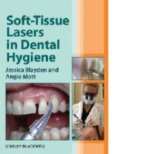 Soft-Tissue Lasers in Dental Hygiene