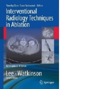 Interventional Radiology Techniques in Ablation