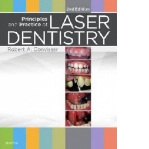 Principles and Practice of Laser Dentistry