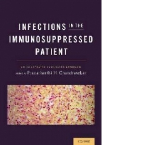 Infections in the Immunosuppressed Patient