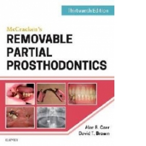 Mccracken's Removable Partial Prosthodontics