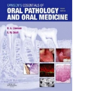Cawson's Essentials of Oral Pathology and Oral Medicine