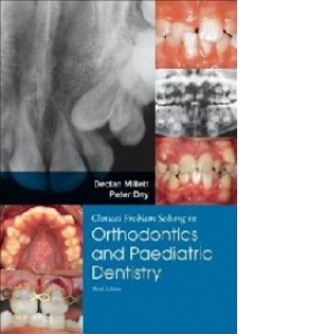 Clinical Problem Solving in Dentistry: Orthodontics and Paed