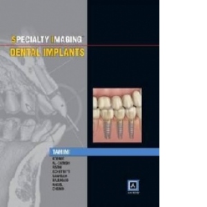 Specialty Imaging: Dental Implants