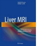 Liver MRI