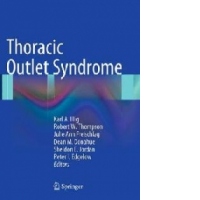 Thoracic Outlet Syndrome