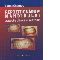 Repozitionarile mandibulei. Aspecte clinice si metode
