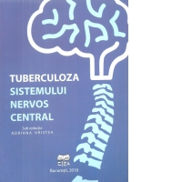 Tuberculoza sistemului nervos central