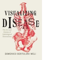 Visualizing Disease