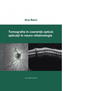 Tomografia in coerenta optica: aplicatii in neuro-oftalmologie