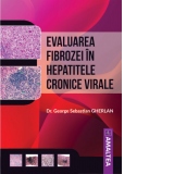 Evaluarea fibrozei in hepatitele cronice virale