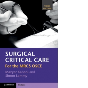 Surgical Critical Care : For the MRCS OSCE