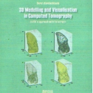 3D MODELLING AND VISUALIZATION IN COMPUTED TOMOGRAPHY (in lb. engleza) (Format Electronic)