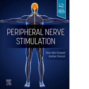 Peripheral Nerve Stimulation : A Comprehensive Guide