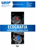 Ecografia Malformatiilor Cardiace Fetale. Brosura + DVD