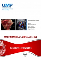Malformatiile Cardiace fetale. Diagnostic si prognostic