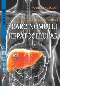 Actualitati in diagnosticul carcinomului hepatocelular