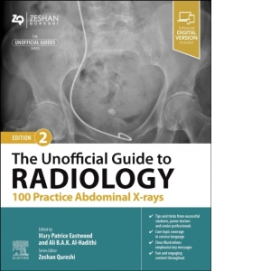 The Unofficial Guide to Radiology: 100 Practice Abdominal X-rays