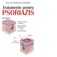 Tratamente pentru psoriazis