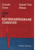 Caiet de electrocardiograme comentate