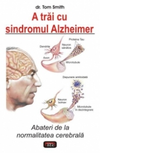 A trai cu sindromul Alzheimer